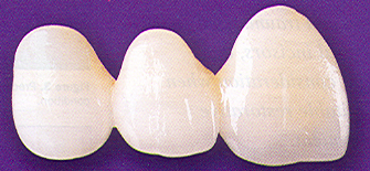 Porcelain Bridge